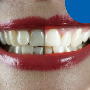 dental treatment for uneven teeth - American Dental Practices
