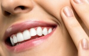 Zoom Teeth Whitening Results - American Dental Practices