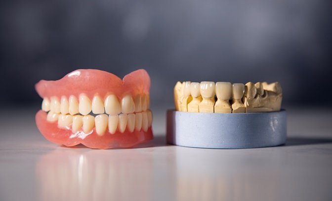 Dental Implants vs Dentures: Which is the Right Choice for You