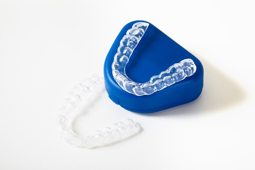 Invisible Braces in Mumbai - Clear Aligners - ADP