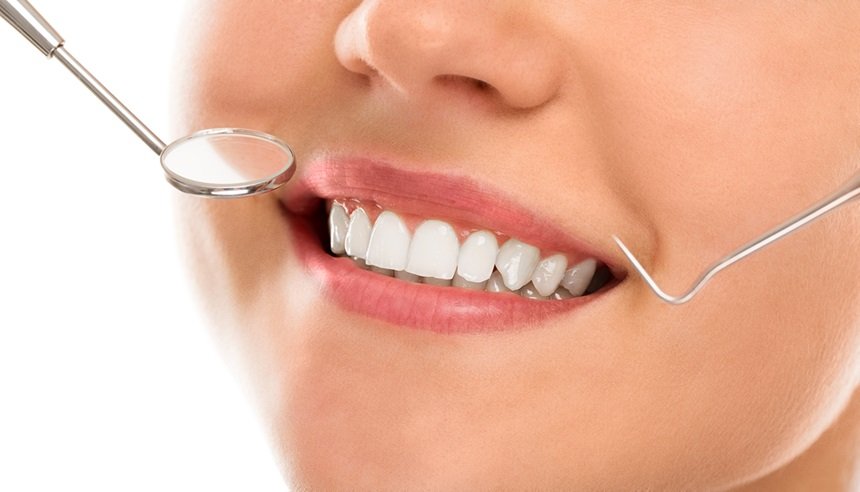 Smile Correction and Smile Makeover in Bangalore - American Dental Practices - Indiranagar - Bangalore