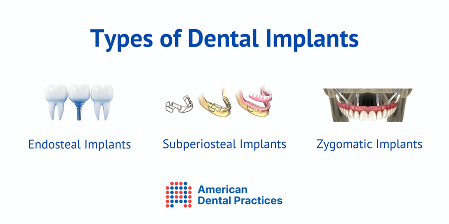 Types of Dental Implants in Bangalore - American Dental Practices - Dental Implants Treatment - ADP Bangalore