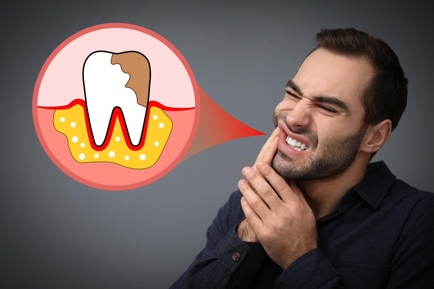 Spots on Your Teeth: Cavity or Stain?Here’s What You Should Know!