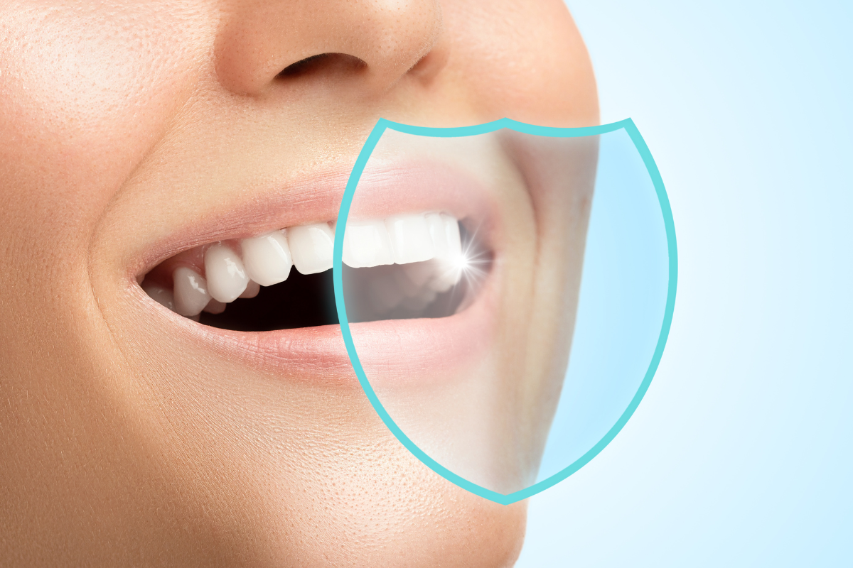 Is Teeth Whitening Safe? What You Need to Know Before Trying It