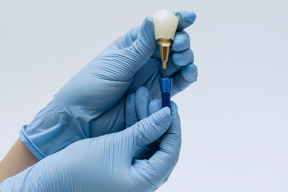 Basal Implants Without Bone Graft: The Best Solution for Severe Bone Loss