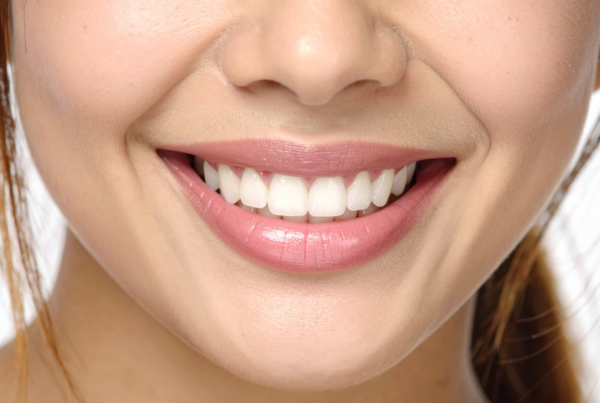 Hollywood Smile - ADP