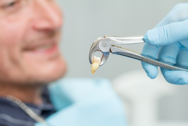 Tooth Extraction - ADP