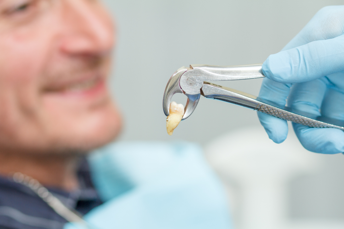 How to Tell If Your Tooth Extraction Is Infected