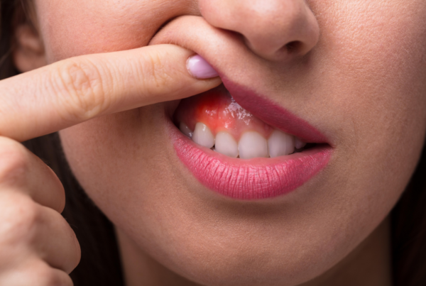 gum boil natural remedy gum Abscess - ADP